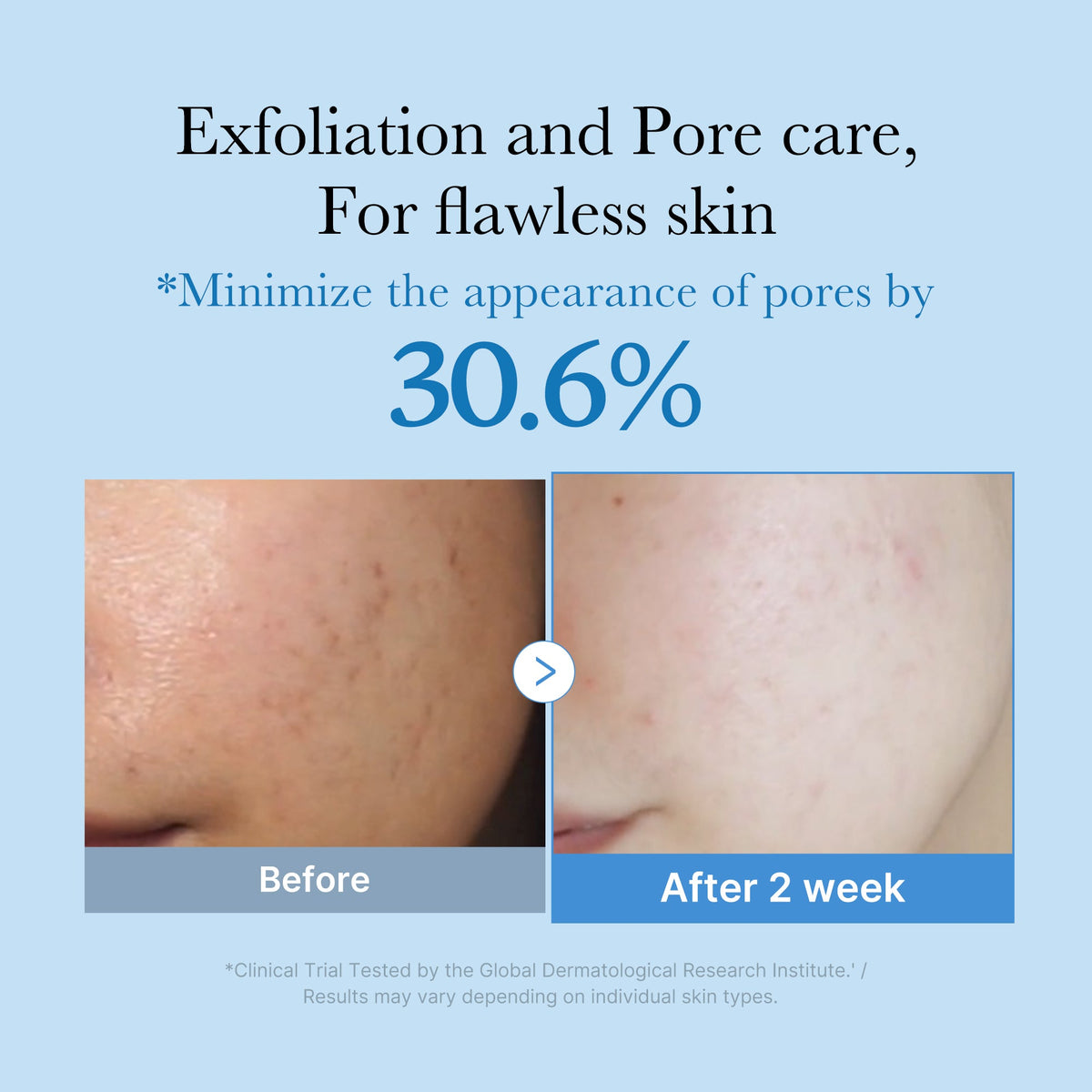 zero-pore-toner-a9 01_d6480b4e-3c08-4954-994a-ed5212c1839c.jpg