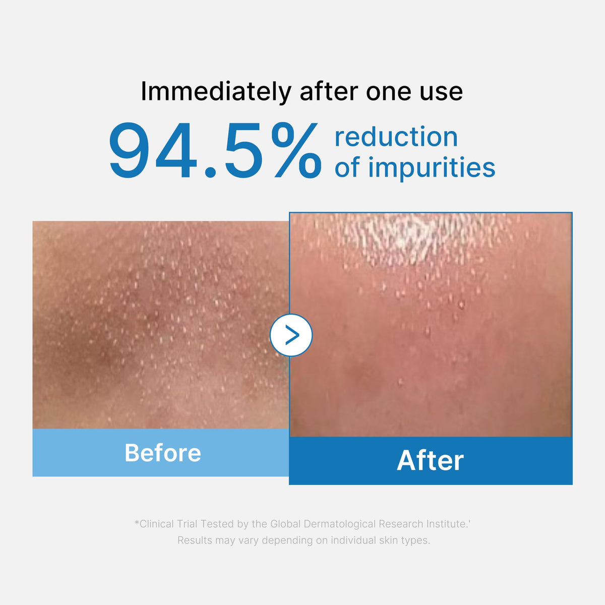 zero-pore-blackhead-deep-cleansing-oil-g6 01_eed557ec-5857-46a2-8b17-dbd67c692dcb.jpg