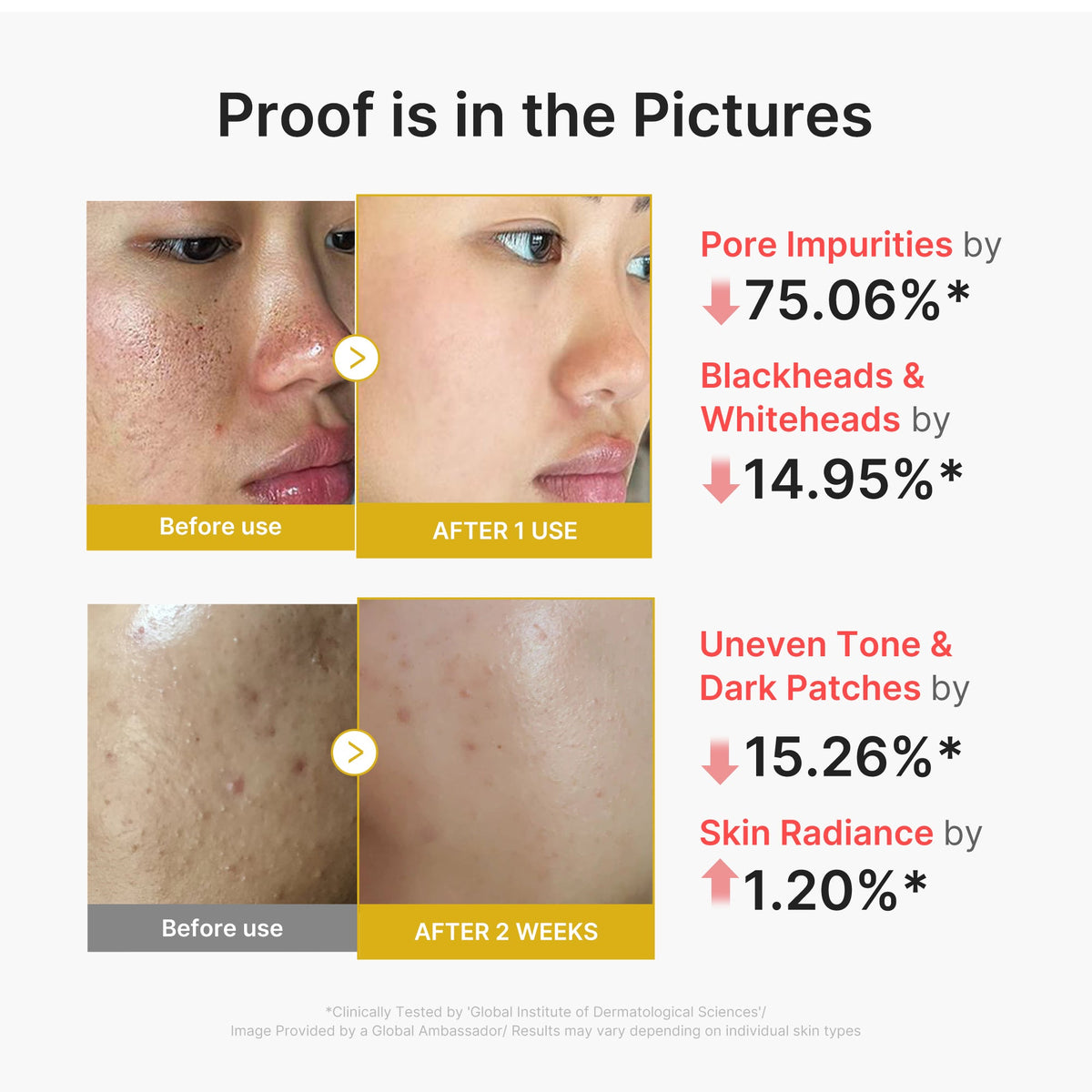 kojic-acid-turmeric-peel-shot-k3 02_45fe66d3-b3f6-4100-aa52-2afd7eded417.jpg
