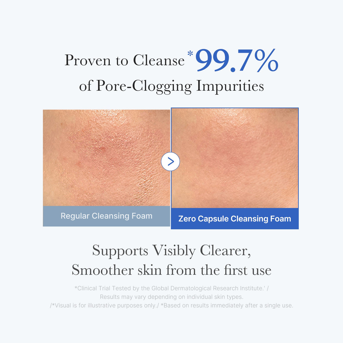 zero-pore-capsule-cleansing-foam-f6 02_c1fb9dfb-86c5-4038-8ff8-490d1006276c.jpg