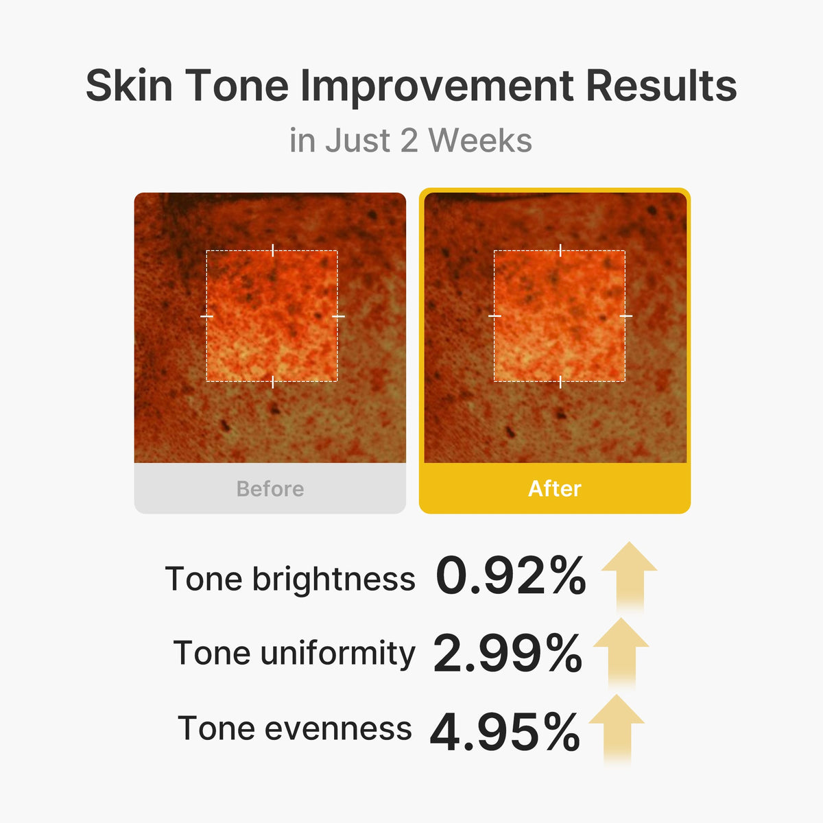kojic-acid-turmeric-vita-capsule-cream-n1 03_2b626701-fc6c-4702-9e96-a2157a4f7f9d.jpg