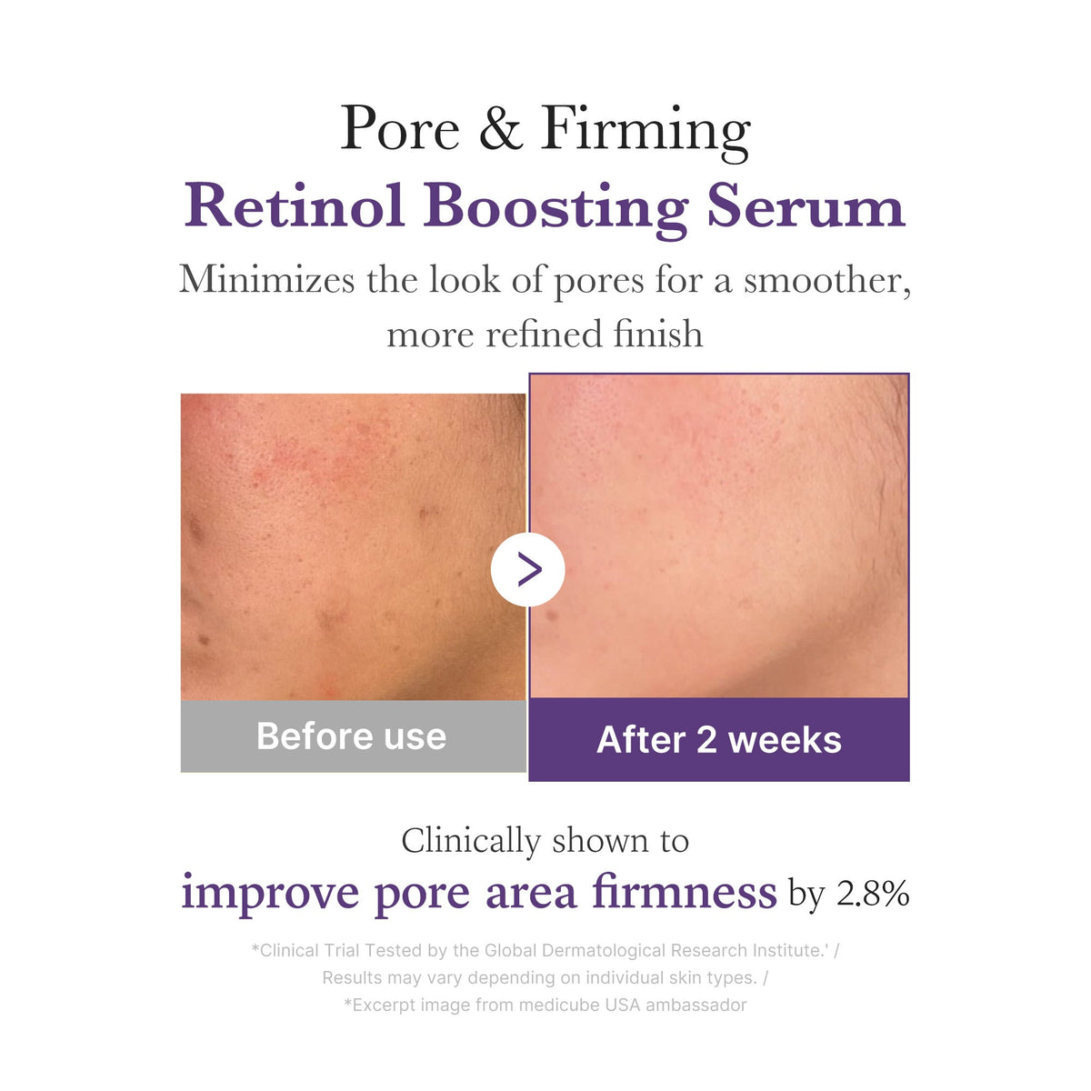 retinol-nmn-boosting-serum-t0 03_3510e7a5-5633-4a18-81ea-1389593bd517.jpg