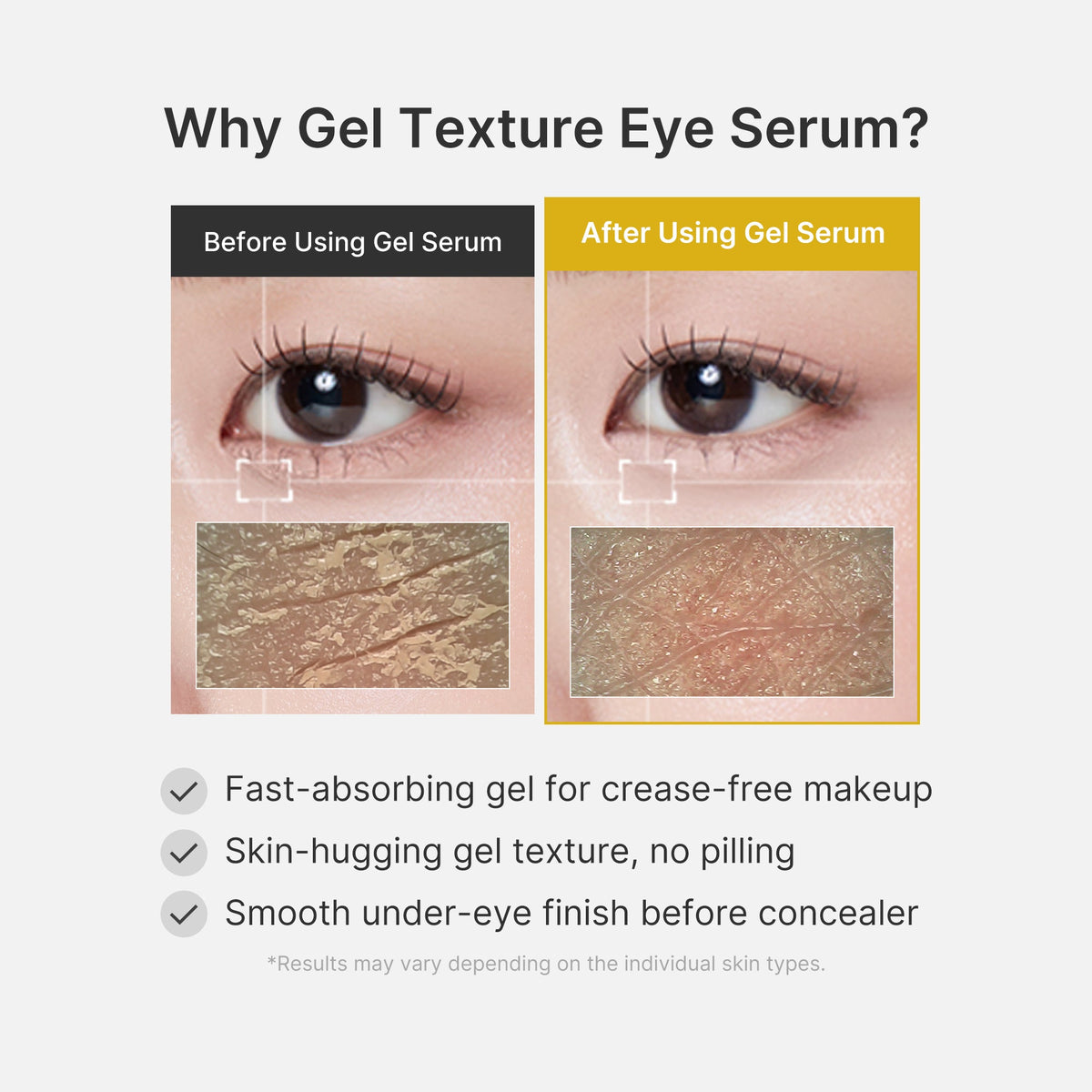 kojic-acid-tumeric-eye-gel-serum-d5 04_0487ef36-49f4-4294-8049-bb55118b05fe.jpg