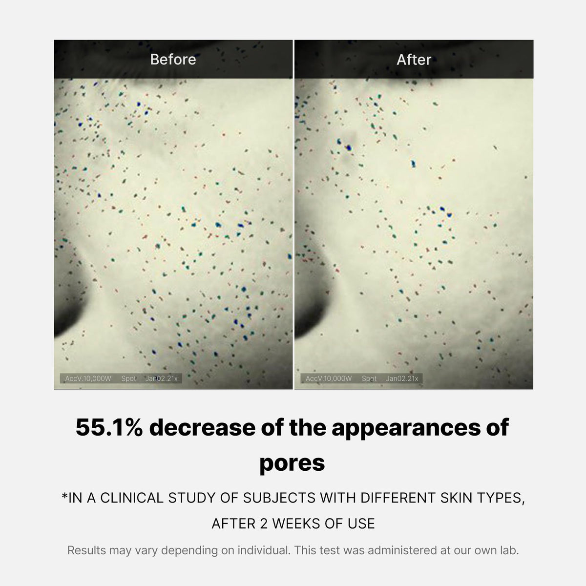 zero-pore-one-day-cream-f8 04_3616addc-f184-4deb-a5d7-e3a782e4713d.jpg