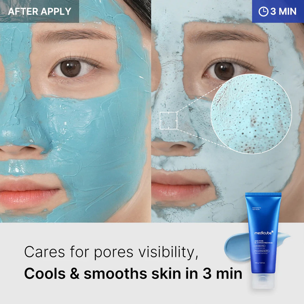 zero-pore-blackhead-mud-mask-f8 04_867c0459-a94e-40d3-bd9a-70400edabe8d.jpg