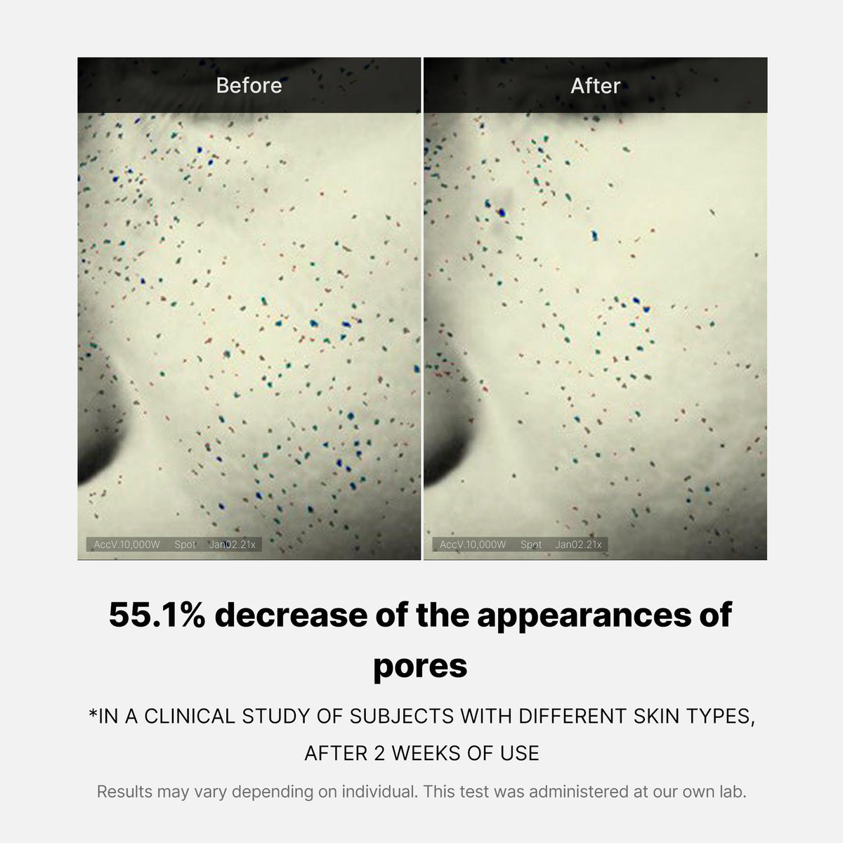 pore-care-duo-l5 05_12ddab8a-64be-4612-8ee1-27e5ec701921.jpg