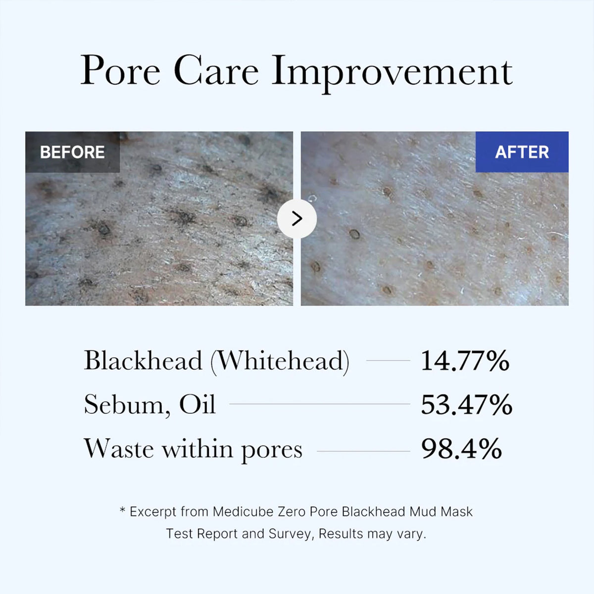 zero-pore-blackhead-mud-mask-f8 05_9362a158-c2b3-4525-acc0-631a2cfdea47.jpg