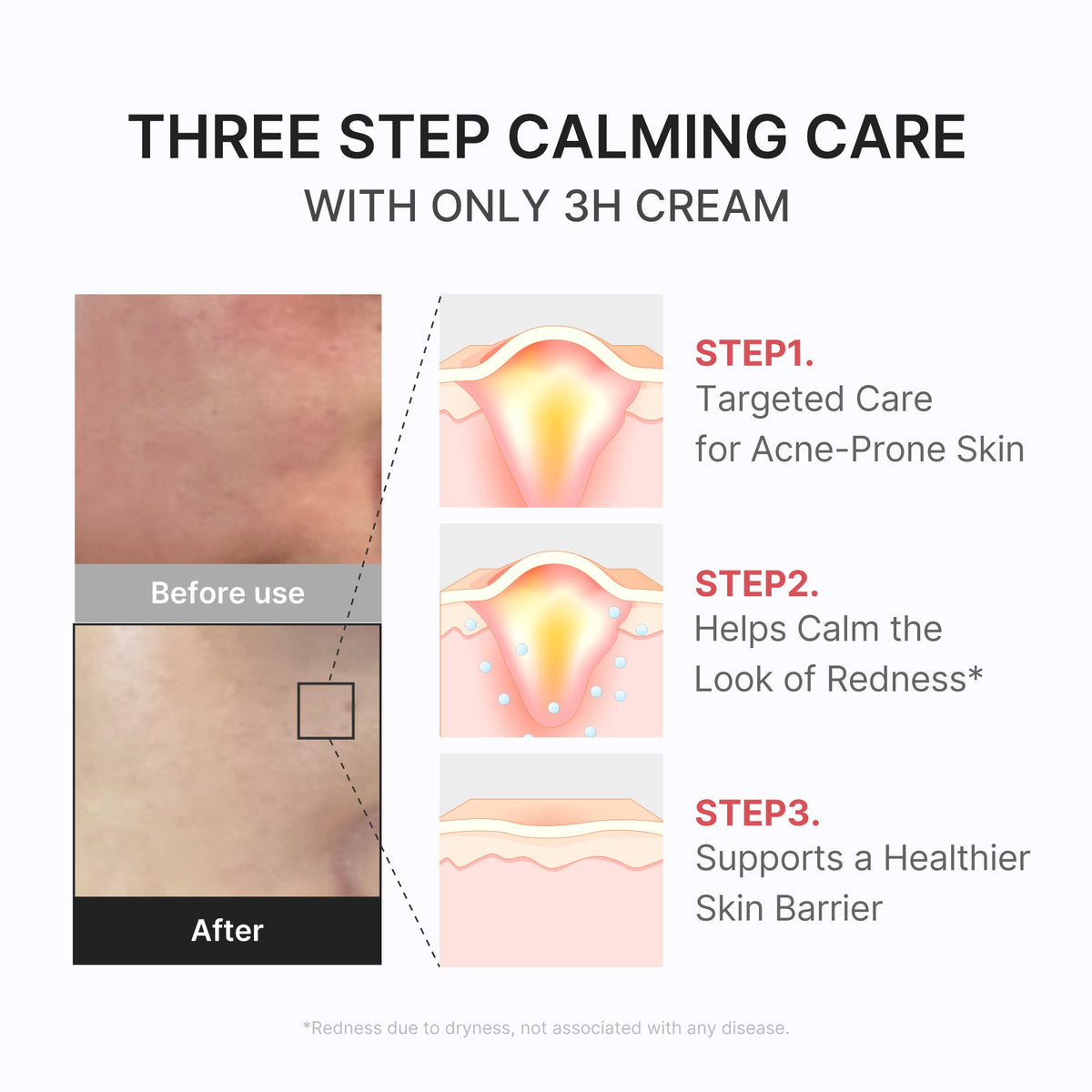 3h-daily-relief-cream-g3 3H_04.jpg