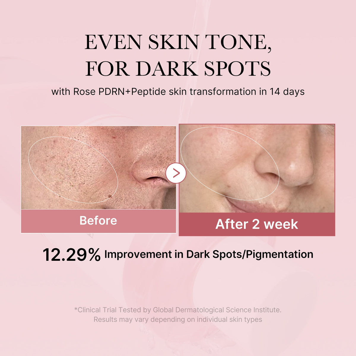 pdrn-pink-peptide-toner-b8 PDRN_01_308c518e-5ac6-4e54-99bd-eabc8796739b.jpg