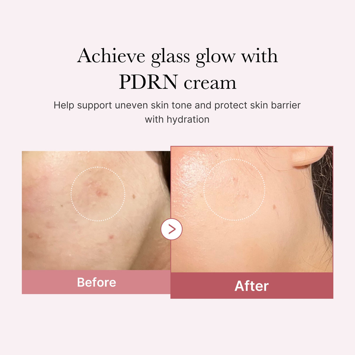 pdrn-pink-peptide-cream-a2 PDRN_02_d7805bfe-cf43-446a-b71b-a276683f136b.jpg