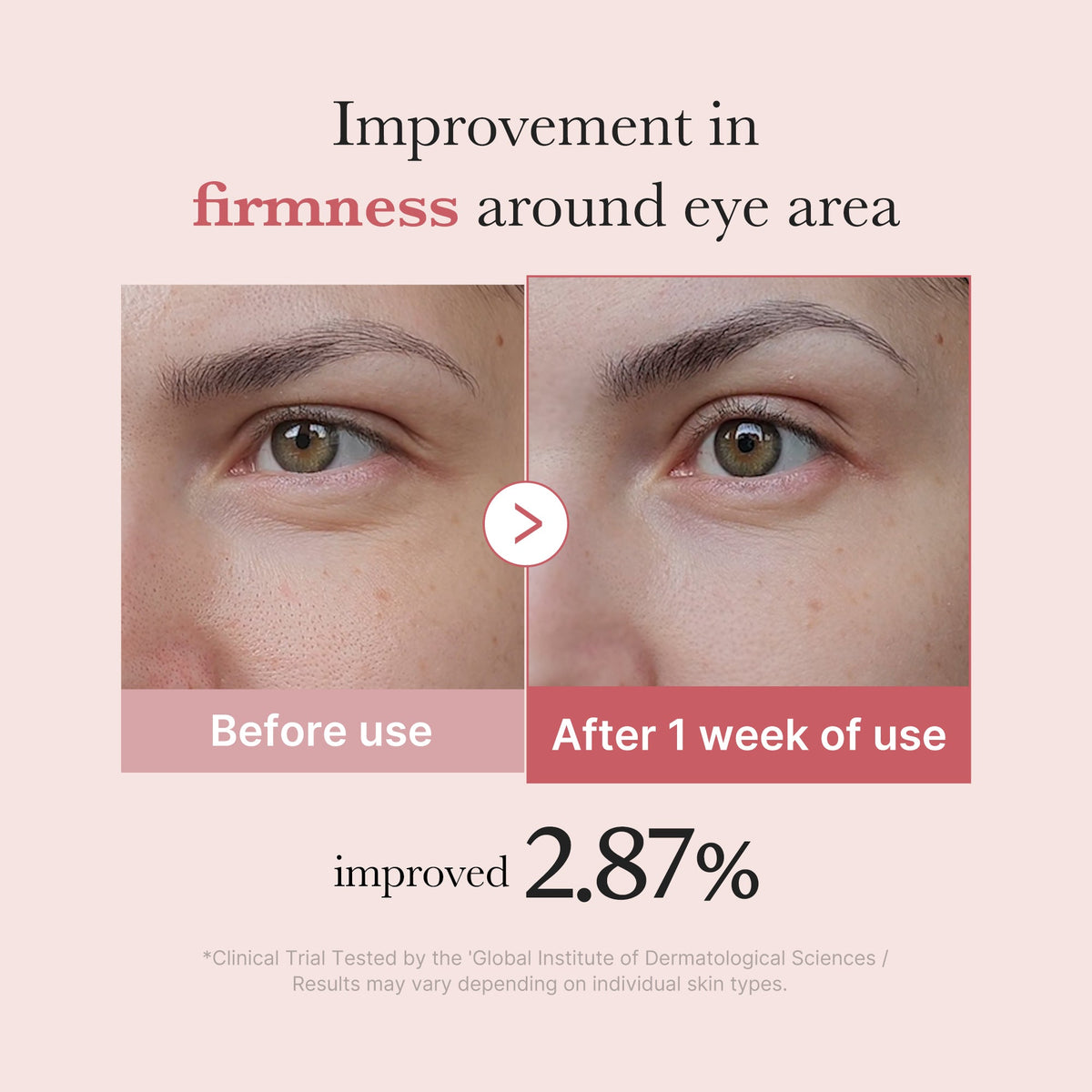 pdrn-pink-peptide-eye-cream-e7 PDRN_03_256dd753-0a2f-41b4-b3cd-bbfd3bc27018.jpg