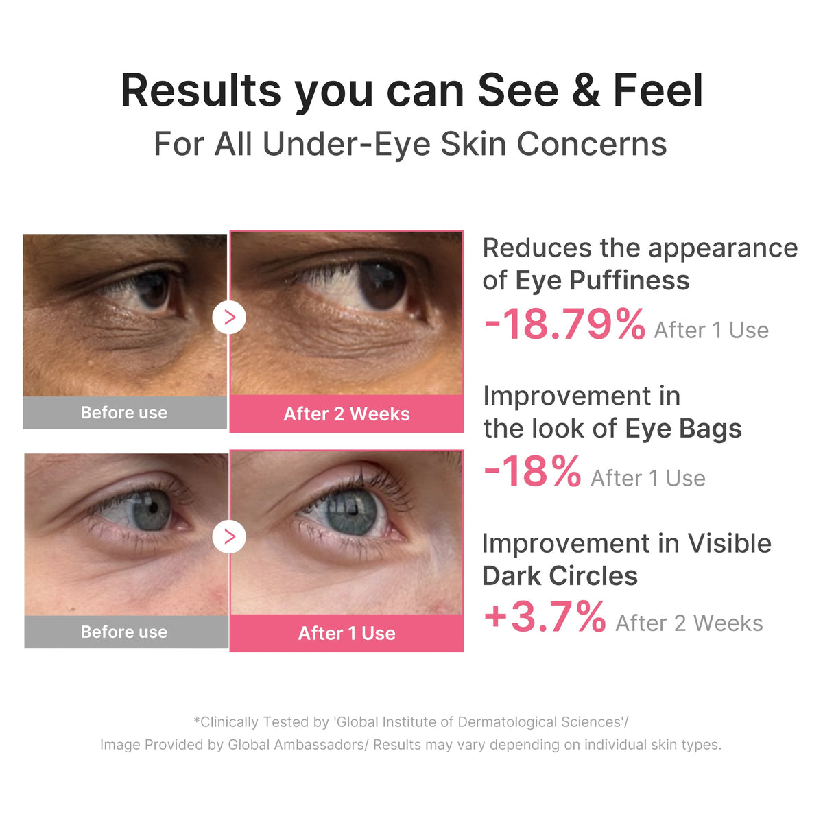 pdrn-caffeine-collagen-eye-patch-y8 PDRN_03_cdce2143-b8d8-43cb-ac69-fcbdf6640249.jpg