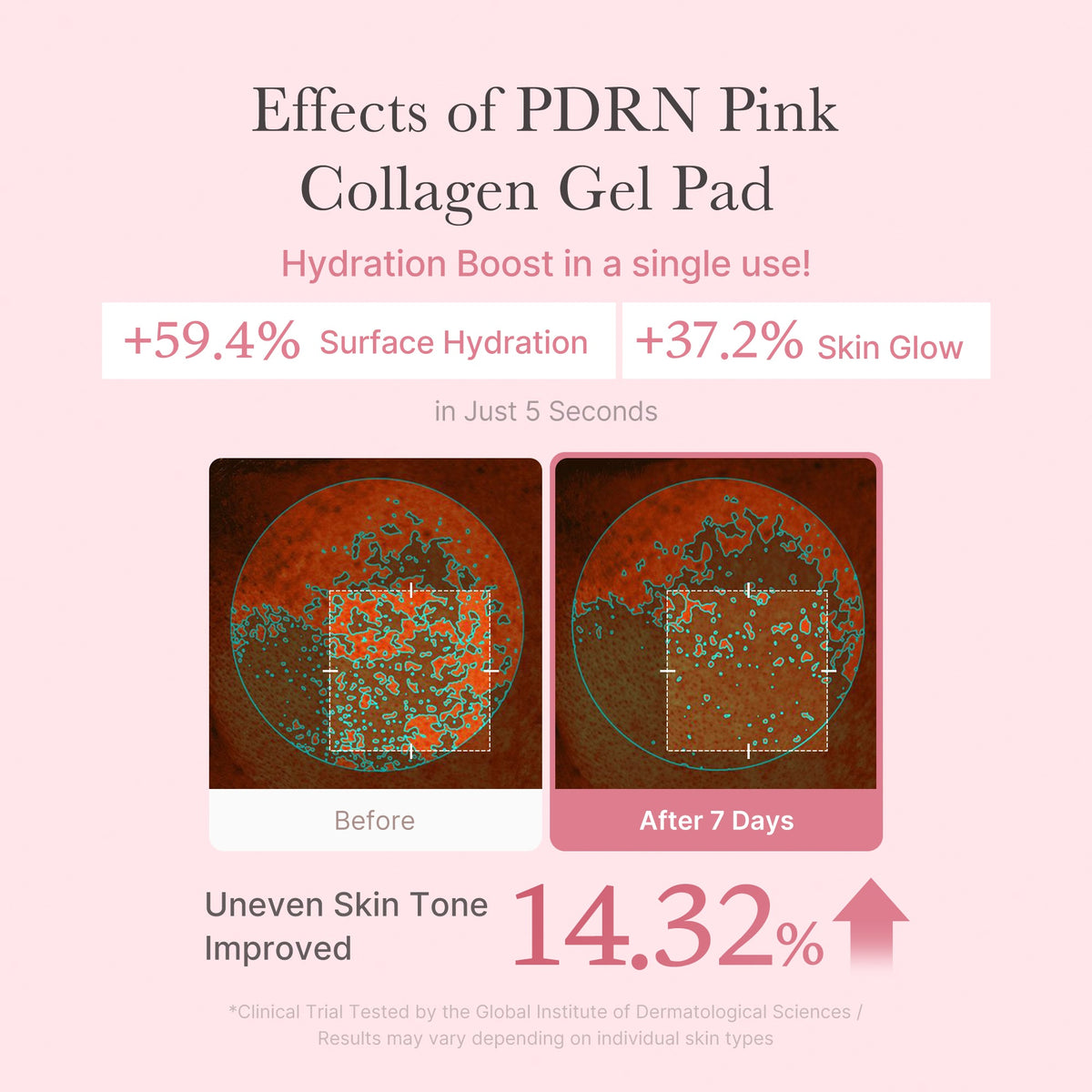 pdrn-pink-collagen-gel-toner-pad-v8 PDRN_04_f9a16a56-8d9e-4c47-a635-ed34ec3ed571.jpg