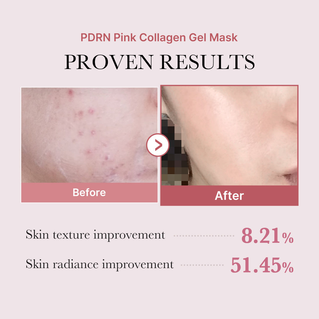 salmon-pdrn-pink-collagen-jelly-gel-mask-j9 PDRN_12.jpg